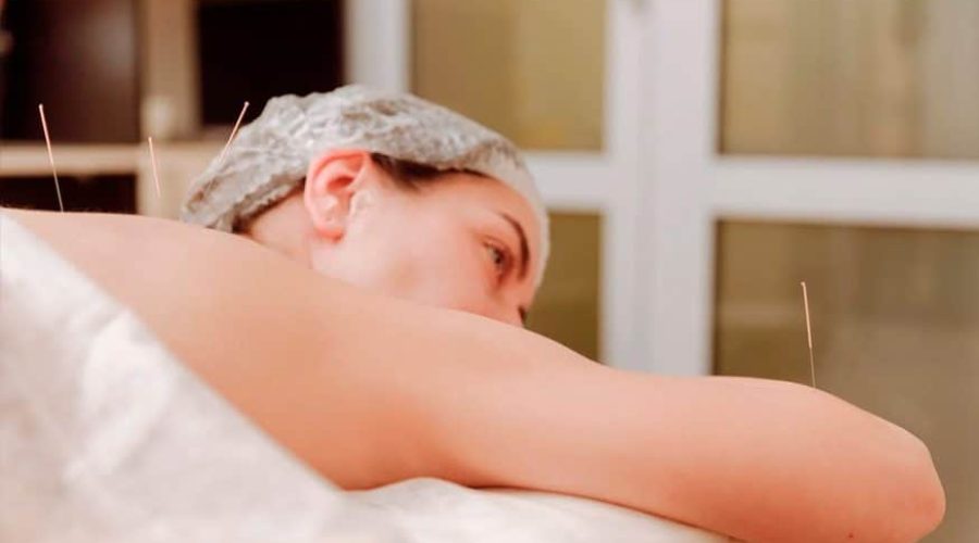 ACUPUNTURA PARA INFERTILIDADE E SAÚDE DA MULHER: UMA ABORDAGEM HOLÍSTICA PARA O BEM-ESTAR FEMININO